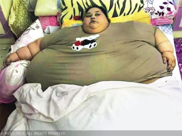 Worlds Fattest Woman Sheds 323kg Fridaypostscom Nigeria Breaking 